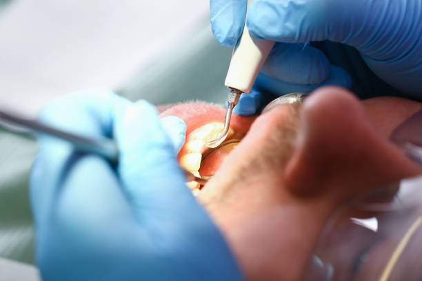 Best Walk-In Emergency Dentist in Ferndale, MI