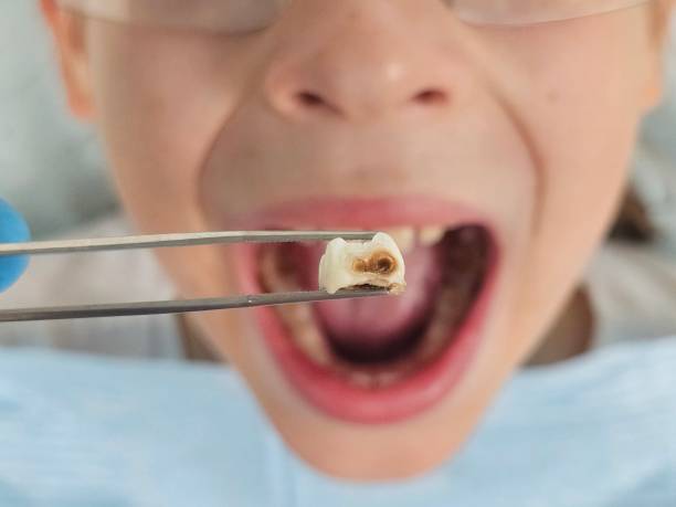 Best Emergency Treatment for Toothache in Ferndale, MI